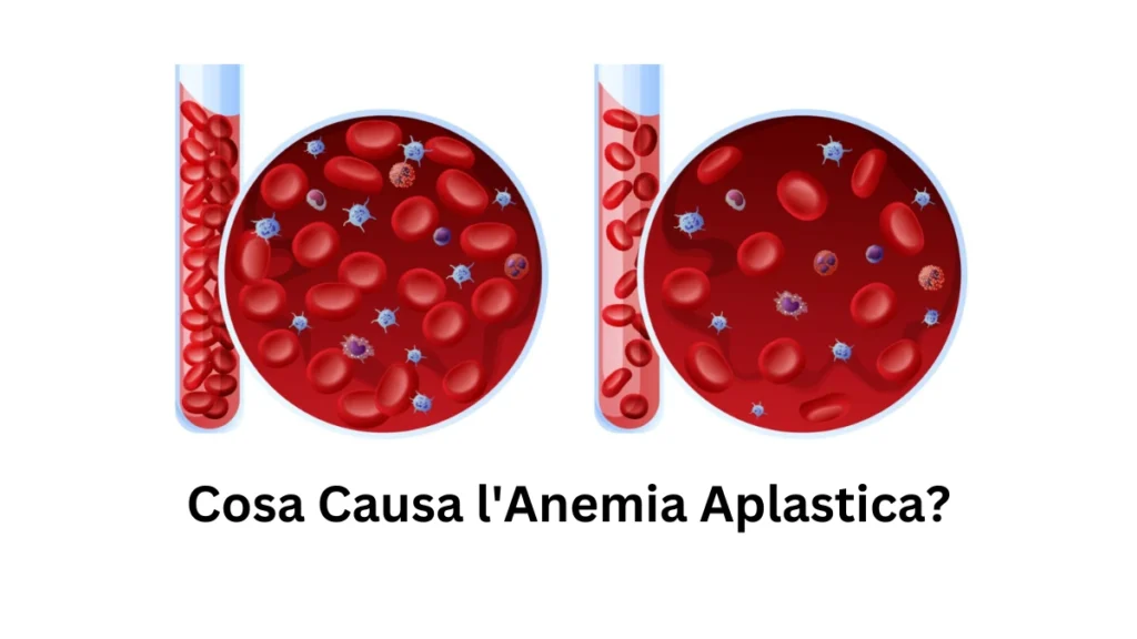 Anemia Aplastica