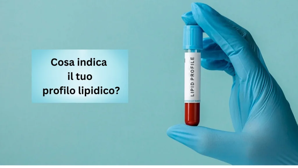 Cosa indica il tuo profilo lipidico